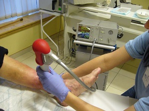 lábszárfekély kezelése a Harmónia Centrumban