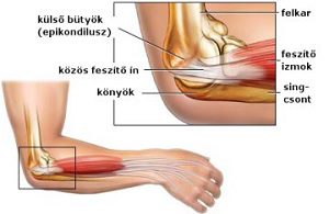 jobb könyökízületi fájdalom kenőcs a lábak ízületeinek arthrosisára