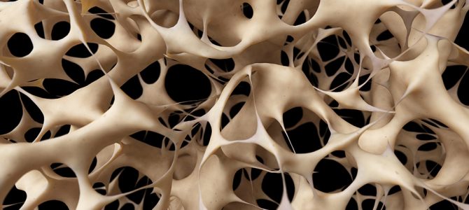 Mit tehet a csontritkulás megelőzésére?