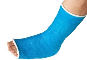 lábközépcsont törés utáni rehabilitáció a csípőízületek gyógyult artrózisa