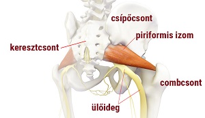 Az egyik ízület deformáló artrózisának oka Csípő fájdalom gördülő lábát