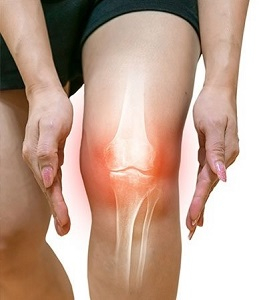 erős éjszakai térdfájdalom csípőízületek arthrosisának kezelése
