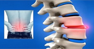 térdfájdalomcsillapító kenőcs éles fájdalom a mellkasi gerincben