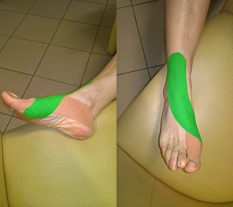 artritisz lábujjak készítményei ízületi ízületi kezelés zselatinnal