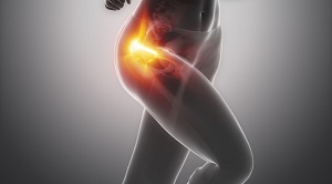 bursitis és a térd ízületi gyulladása legjobb gyógymód az ízületi fájdalmakhoz