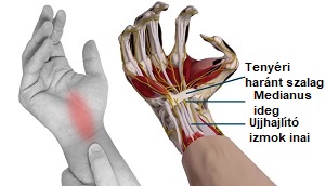 fáj egy csuklóízület az ujjak ízületei és típusai