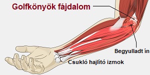 fájdalom az izmok kezet cukorbetegség kezelésében)