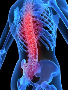 hogyan lehet gyógyítani a hátfájást rheumatoid térdfájdalom