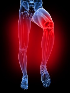 fájó lábak térd alatti kezelése ropog a csípőízületi fájdalom