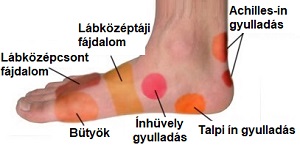 fájó lábak és ízületek séta után tabletták a bokaízület ízületi gyulladásáért