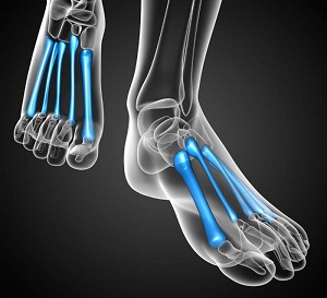 lábközéptáji fájdalom térdszalagok sérülése