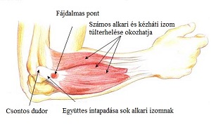 Gyakorlatok a könyökízület fájdalmához A boka ízületei sérülés közben sérülnek