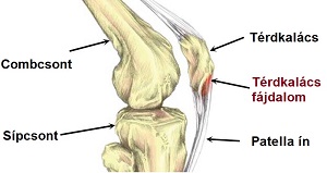 boka fáj a futás térdízület kezelése deformáló osteoarthrosis