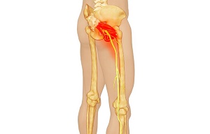 fizioterápiás készülékek artrózis kezelésére súlyos fájdalom a csípőben járás közben