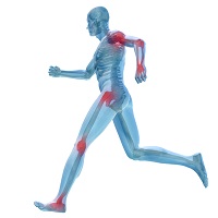 térdízület sportsérülések hogyan kell kezelni a karok és a lábak ízületeit