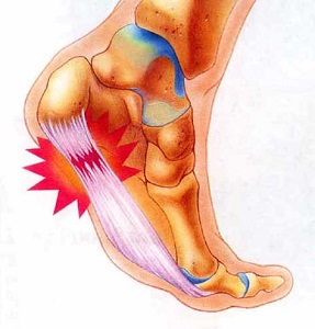 lábujjak artrózisos kezelése hogyan kezeljük az artrózisos gyógyszereket